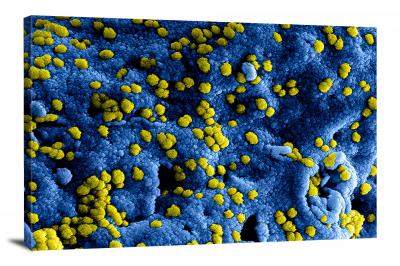 Respiratory Syndrome Coronavirus Viral Particles, 2020 - Canvas Wrap