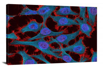 Cells from Cervical Cancer, 2021 - Canvas Wrap