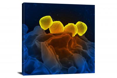 CW6908-microscopic-streptococcus-pyogenes-bacteria-00