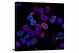 Human Colorectal Cancer Cells, 2019 - Canvas Wrap