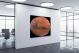 Planet Mars, 2011 - Canvas Wrap1